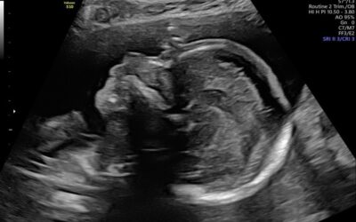 3e Regionale Echo Casuïstiekbespreking